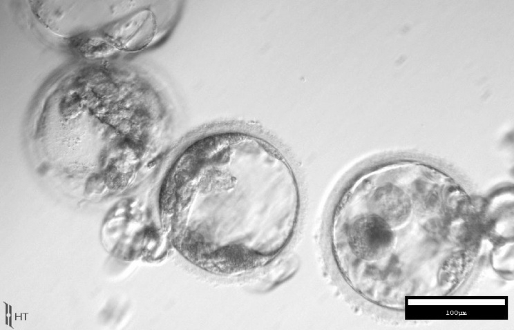 СМИ: ученым США удалось клонировать стволовые клетки из тканей взрослого человека