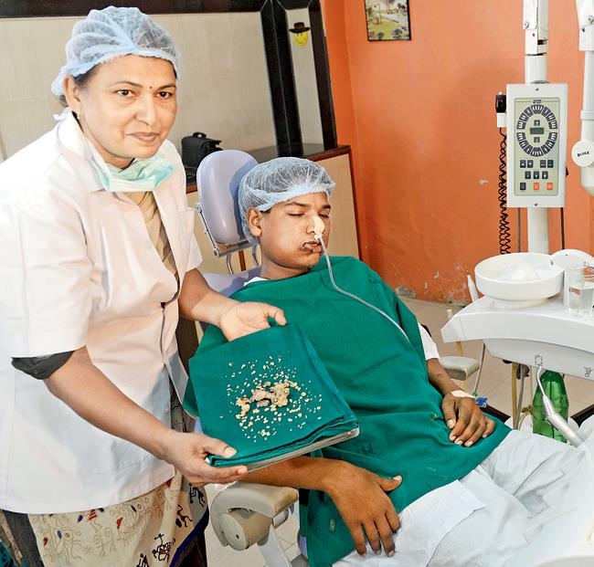 Հնդիկ վիրաբույժները հեռացրել են դեռահասի 232 ատամները  