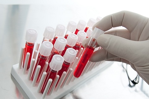 American scientists discovered that blood test could predict risk of suicide
