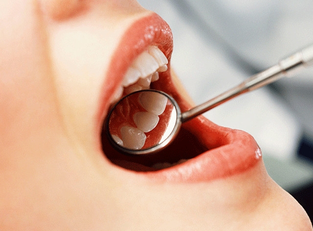 Հայ ֆիզիկոսների նորարարությունը ատամնաբուժության մեջ

 