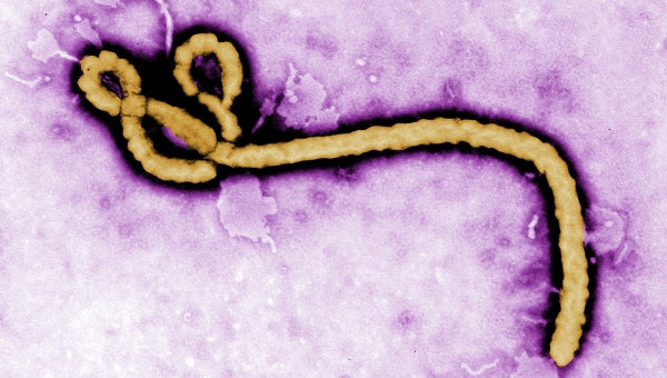 В Японии разработан метод, за 30 минут определяющий вирус Эбола
