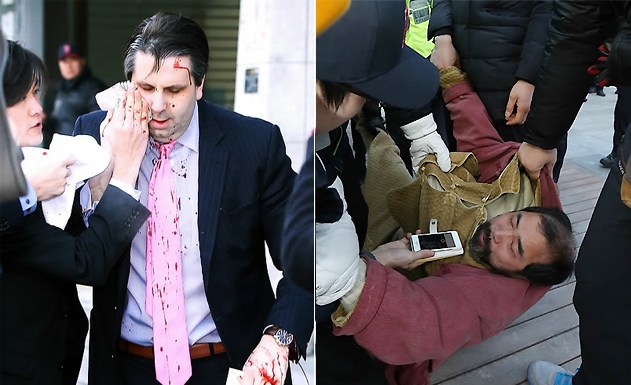 US ambassador to South Korea injured by knife-wielding attacker