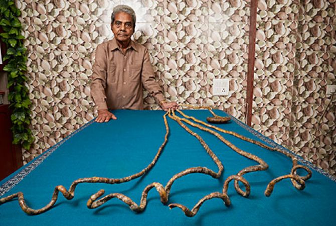 Отращивавший ногти с 1952 года индиец побил мировой рекорд