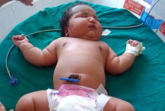 В Индии родилась девочка весом почти в 7 кг