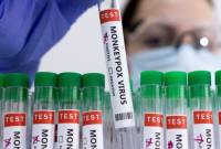 First case of monkeypox virus registered in Georgia