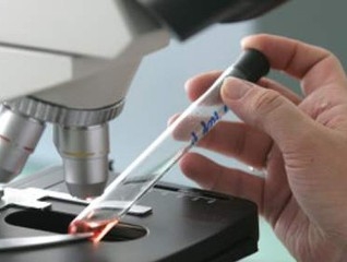 Ադրբեջանում 750 հազար հեպատիտով հիվանդ կա. ադրբեջանցի փորձագետ