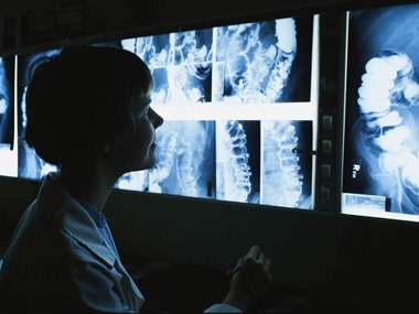 Armenia recorded success in struggle against tuberculosis 