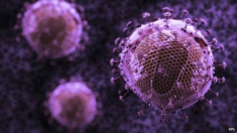 HIV evolving "into milder form"