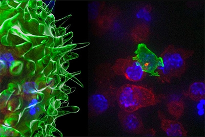 Ученые сняли на видео атаку Т-киллеров на раковые клетки
