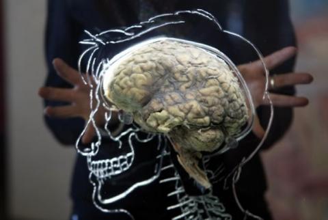 American scientists grow human brain in lab