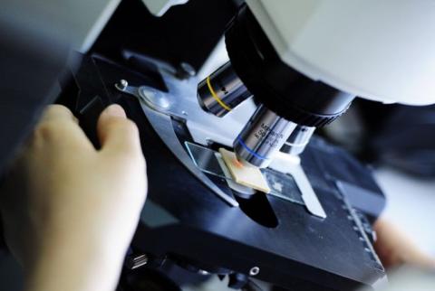Scientists open the ‘black box’ of schizophrenia with dramatic genetic discovery