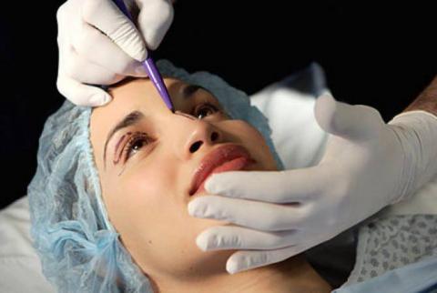 Armenia has great potential to develop medical tourism via plastic surgeries