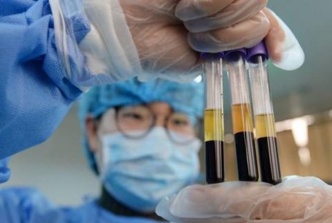 В Китае разработали тест, способный выявить новый коронавирус за 8-15 минут