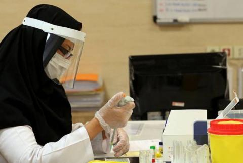 Группа иранских ученых создала тест, подтверждающий ранее перенесеное коронавирусное заболевание