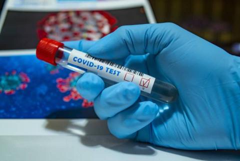 В Армении подтверждено 596 новых случаев COVID-19: выздоровели 45 человек, скончались 7
