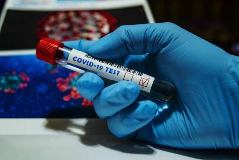Арцах направит помощь в США для борьбы с COVID-19
