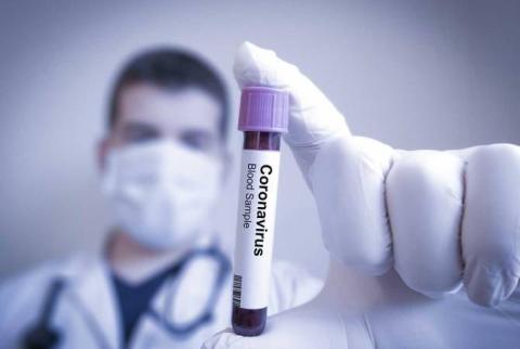 В Арцахе на стационарном лечении находятся 25 больных COVID-19