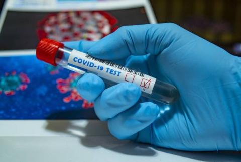 Artsakh records 9 daily coronavirus cases
