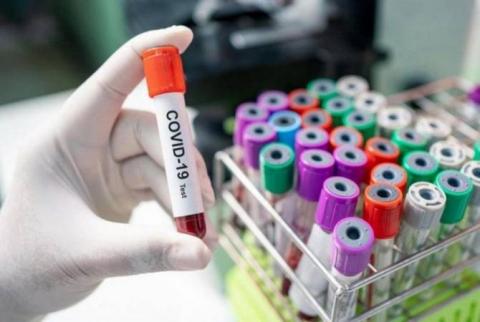За последние сутки в Грузии выявлено 1 364 новых подтвержденных случая заражения коронавирусом