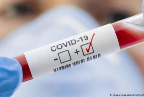 ԱՊՀ-ն  քննարկում է COVID-19-ի դեմ պատվաստումների վկայականների փոխադարձ ճանաչման հարցը
