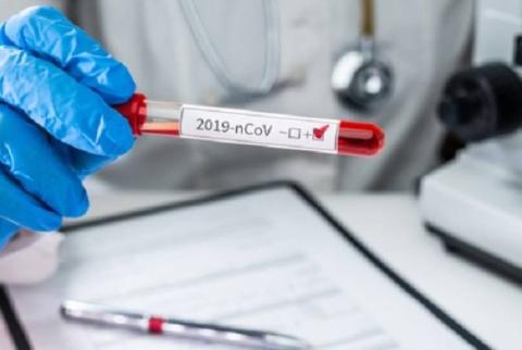 COVID-19: в Арцахе подтверждено 5 новых случаев   