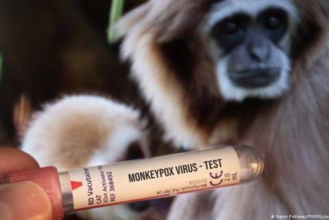 В России зарегистрирован первый случай обезьяньей оспы 