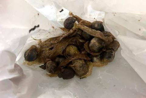 Drug mule carrying over 120 packages in gastrointestinal tract detained in Yerevan airport 