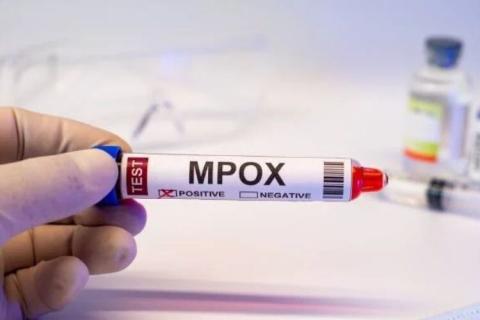 Ֆիլիպիններում հայտնաբերվել է mpox վիրուսի՝ այս տարի առաջին դեպքը