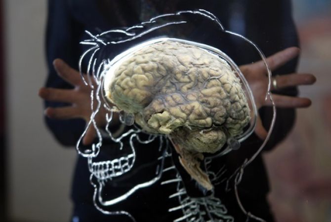 American scientists grow human brain in lab