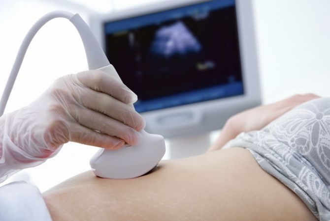 Sex-selective abortions to be forbidden by law in Armenia