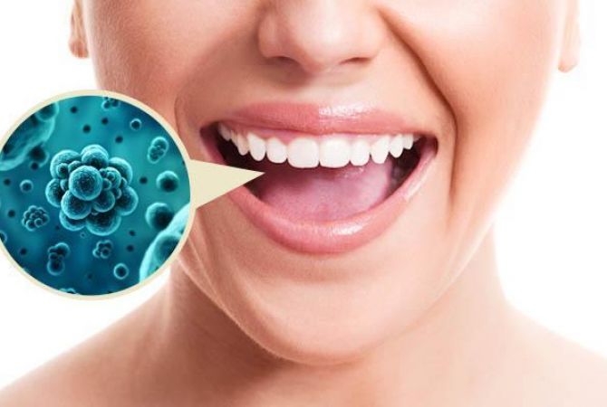 Бактерии в полости рта могут вызывать мигрень: ученые