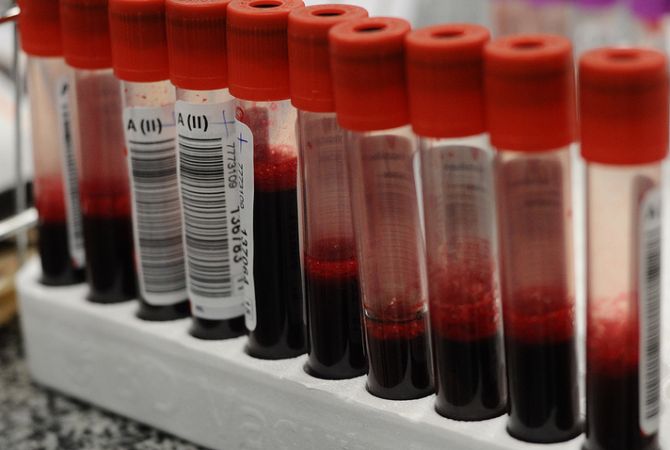 СМИ: ученые из Китая разработали методику определения группы крови за две минуты