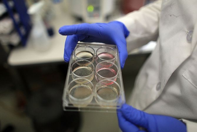 В Японии впервые в мире пациенту пересадили iPS-клетки другого человека