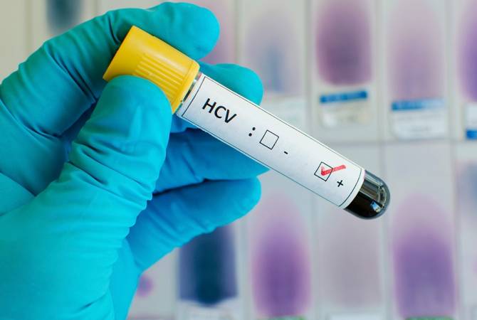 Healthcare ministry continues hepatitis C treatment program 