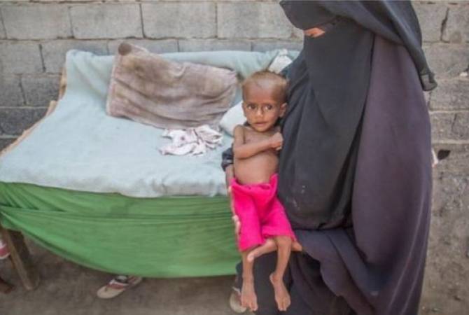 Почти 85 тыс. детей погибли от голода в Йемене за время конфликта