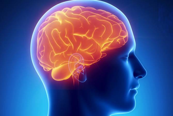   Հայաստանը ներդնում է գլխուղեղի անոթների ստենտավորման ծրագիր