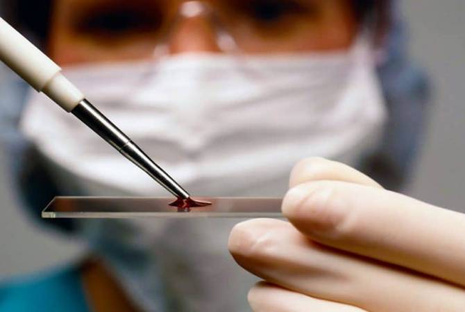 В Сингапуре впервые в мире начнут делать анализ крови на обнаружение рака желудка