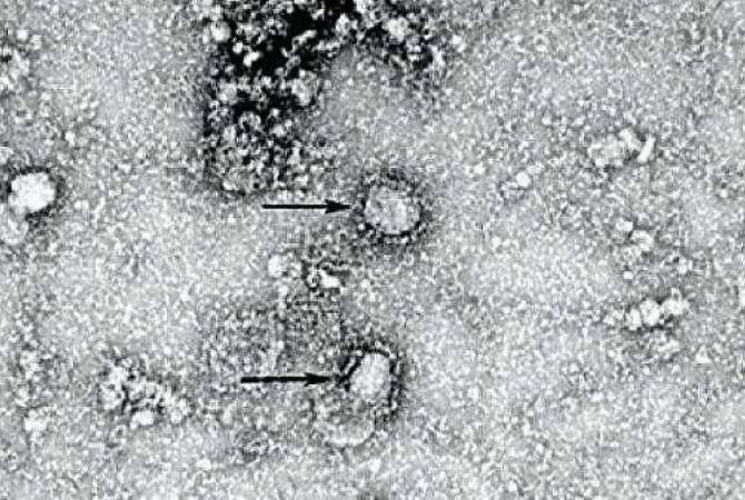 Китай опубликовал снимок нового коронавируса с электронного микроскопа