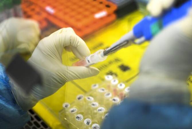 Японская компания с 16 марта начнет продавать тесты для выявления коронавируса за 15 
минут