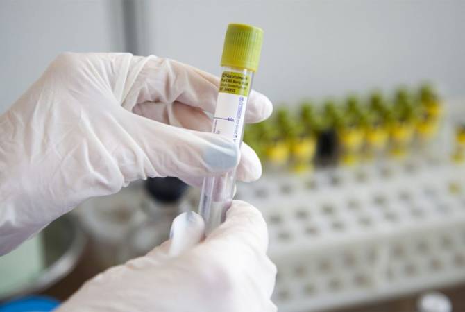 Первый волонтер в США получит экспериментальную дозу вакцины от коронавируса
