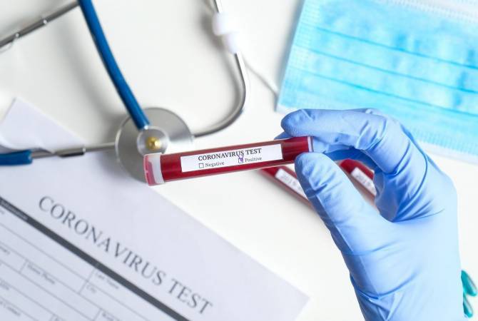 Число подтвержденных случаев коронавируса в Армении достигло 64


