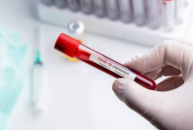 Министерство здравоохранения Армении приобретет более 5000 тестов на коронавирус

