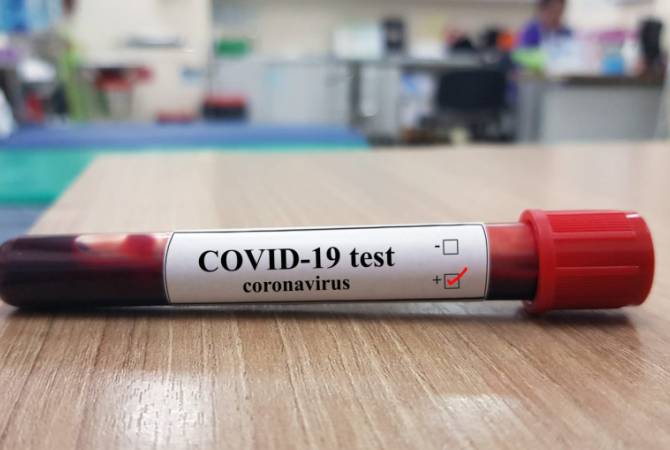 ԱԱՏՄ-ն վարույթ է հարուցել կորոնավիրուսը բուժող դեղորայքի մասին լուրեր տարածող 
անձին գտնելու համար
