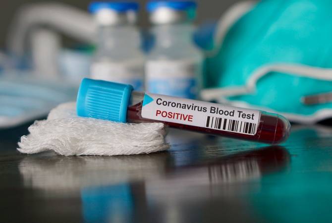  В Армении 110 подтвержденных случаев коронавируса

 