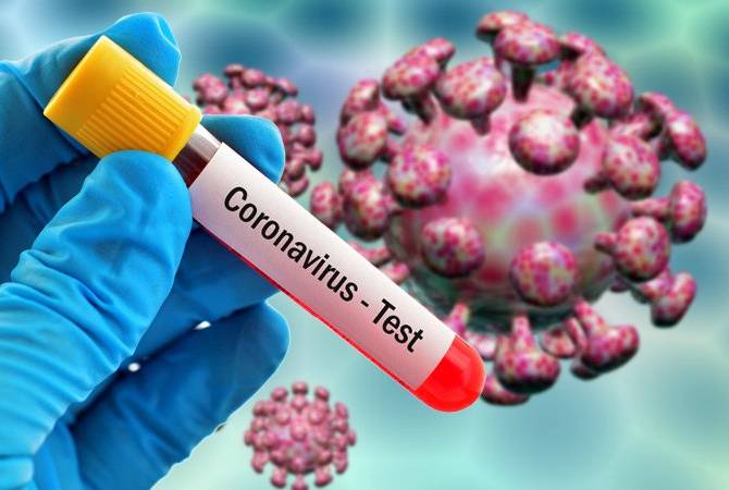  133 из 160 подтвержденных случаев коронавируса в РА связаны с  Эчмиадзином и 
предприятием в Ереване  