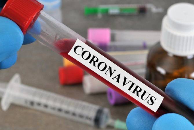 Armenia reports 52 coronavirus cases in one day, total cumulative number reaches 424 