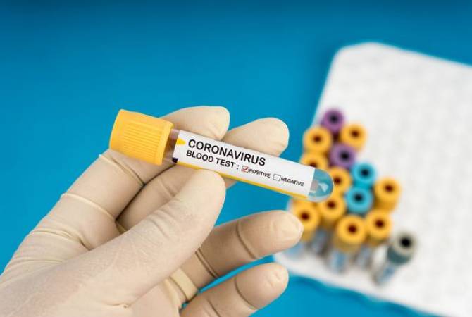 АРМЕНИЯ: Подробности конкурса на гранты по проектам по предотвращению распространения коронавируса