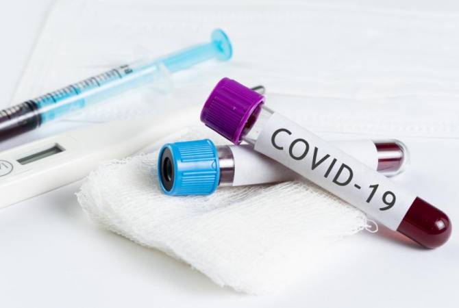 Armenia coronavirus cases reach 1,039