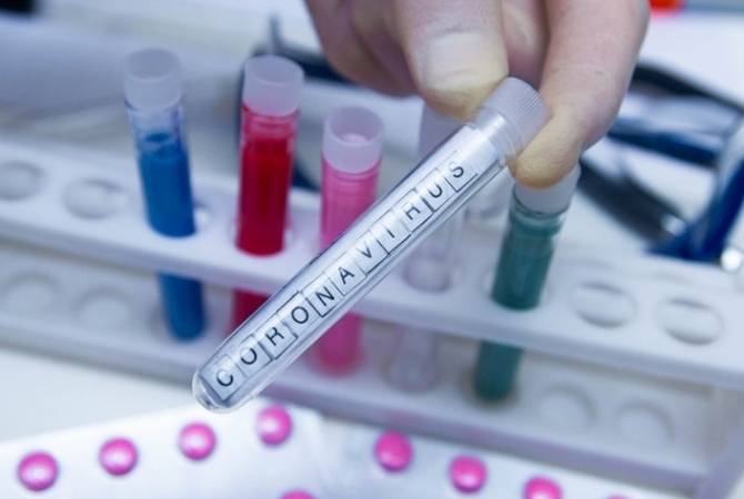 Յուրաքանչյուր 4-րդ դեպքում կորոնավիրուսի հակագենային թեստերը կարող են կեղծ դրական արդյունք տալ. հետազոտություն