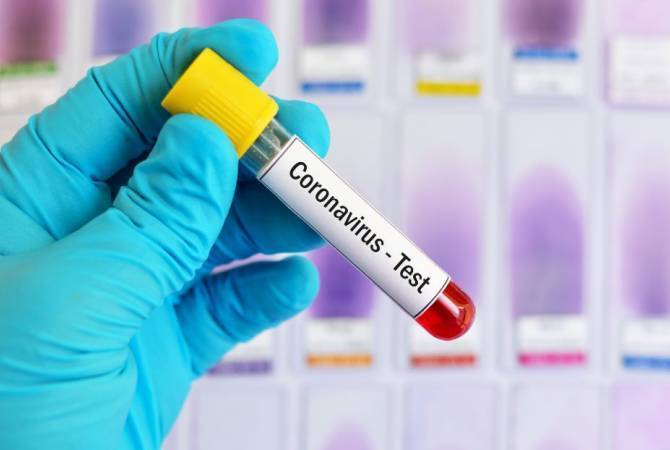 В Армении за сутки выявлено 134 новых случаев инфицирования коронавирусом

